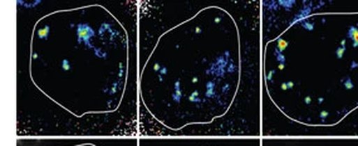 Endosomal pH maps in single cells at 5 minutes, 1 hour and 2 hours